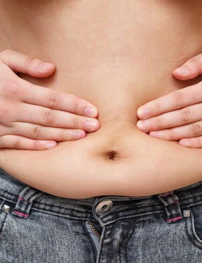 Diastasis Recti Treatment in Coimbatore